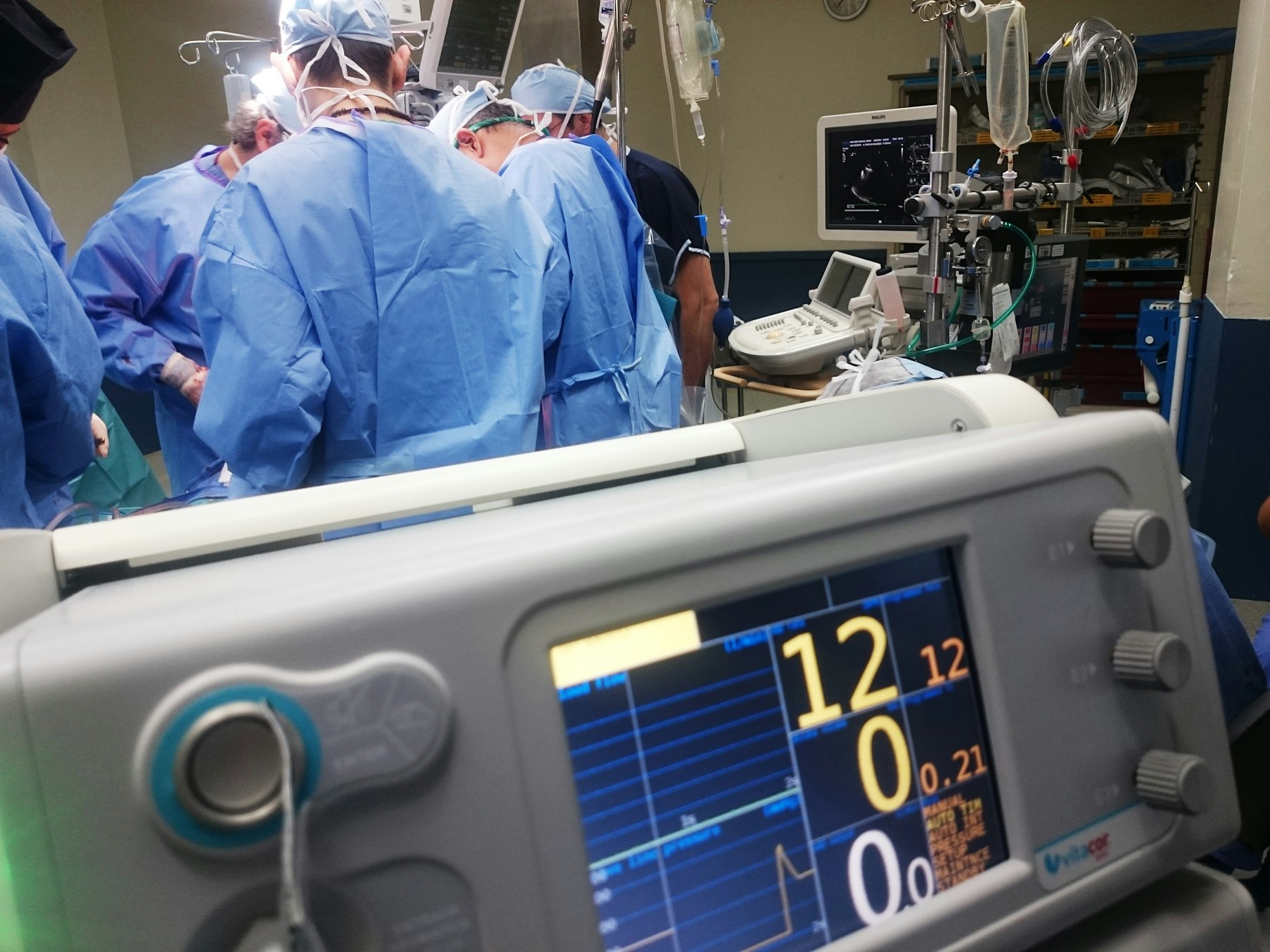 Operating team working beside a live patient monitor